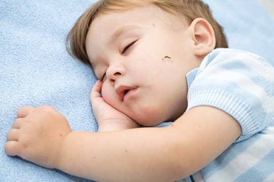Những cách hiệu quả để giảm ngứa và sưng tấy do muỗi đốt cho bé 